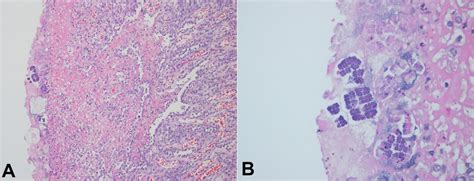 Photomicrograph Of The Stomach A Sarcina Ventriculi Identification In