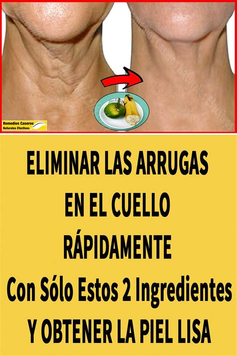 Eliminar Las Arrugas En El Cuello RÁpidamente Con Sólo Estos 2 Ingredientes Y Obtener La P