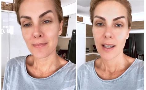 Ana Hickmann agradece apoio após denunciar marido por agressão Vou