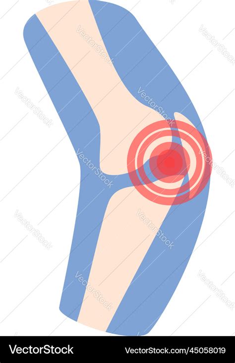 Knee pain icon cartoon arthritis joint Royalty Free Vector