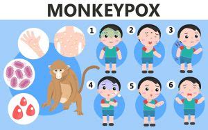 How is the monkeypox spread from one person to another? - Freemediinfo