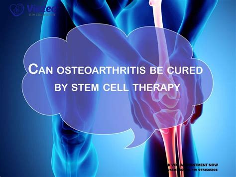 Can Osteoarthritis Be Cured By Stem Cell Therapy