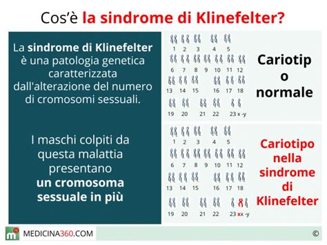 Sindrome Di Klinefelter Sintomi Cause Test E Cura