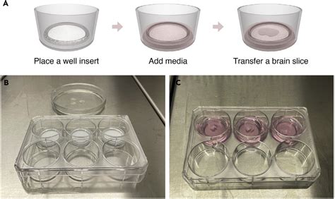 Brain Slice Culturing A Graphical Illustration Of The Steps For