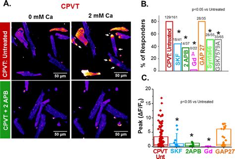 LoCEs Are Inhibited By SOCE And ORAI Inhibitors A Representative