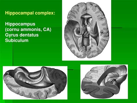 Ppt Telencephalon Powerpoint Presentation Free Download Id9733356