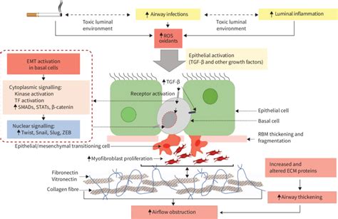 Schematic Of Epithelial Mesenchymal Transition Emt In Cigarette Smoke