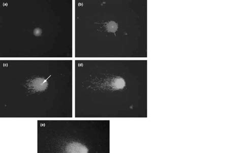 Examples Of Sperm Nuclei With Varying Degrees Of Halo Formation Dna Download Scientific