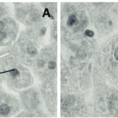 Morphological differences of the cell nucleus (black arrows) and ...