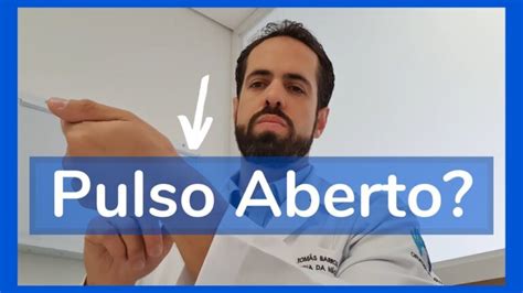 Como Saber Se Abriu O Pulso - Como identificar se você abriu o pulso | Actualizado marzo 2026