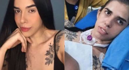 Thais Medeiros recebe alta após lesão no cérebro por cheirar pimenta