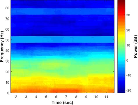 Example of spectrogram extracted in a normal EEG segment. | Download ...