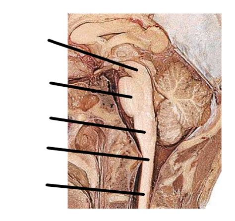 Brainstem And CNs Division 1 Diagram Quizlet