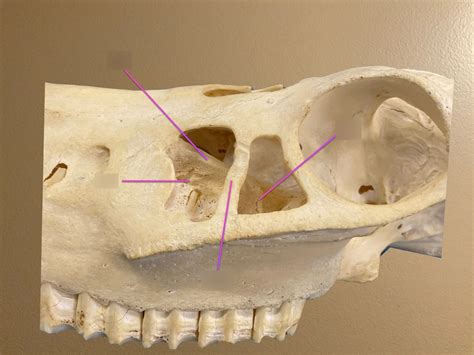 Paranasal Sinuses Lateral View Diagram Quizlet