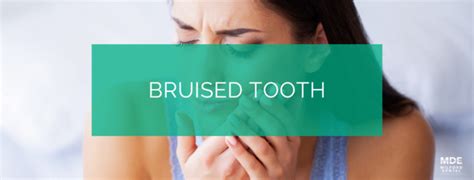 Oral Health Conditions Dentist In Milford Oh