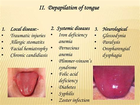 Diseases of tongue | PPT