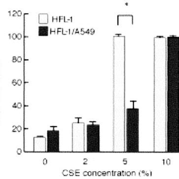 Effect Of Cse On Fibroblast Mediated Collagen Gel Contraction Exposure