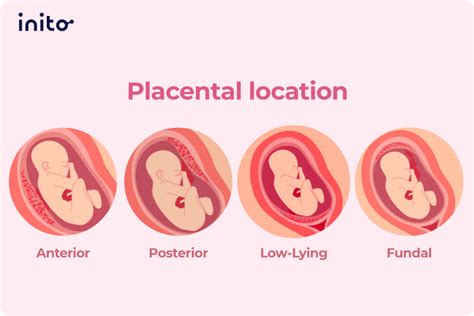 What Does It Mean To Have A ‘posterior Placenta’ Inito