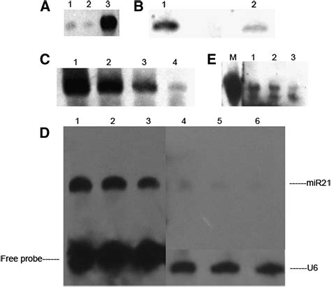 Simple And Nonradioactive Detection Of MicroRNAs Using Digoxigenin DIG