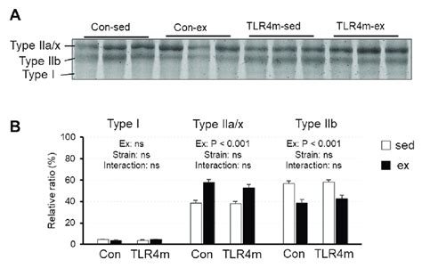 The Relative Expressions Of Myosin Heavy Chain Mhc Isoforms B In