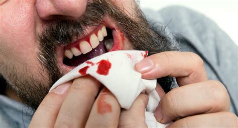 Bleeding Gums Creekstone Dental