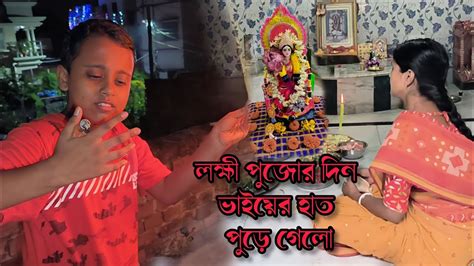 বাড়িতে লক্ষী পুজোর দিন ভাইয়ের হাত পুড়ে গেলো Youtube