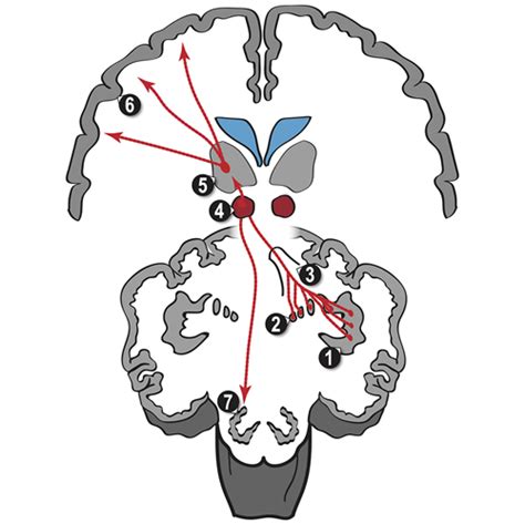 Illustration Of The Anatomical Structures Involved In The Drtt Fibers