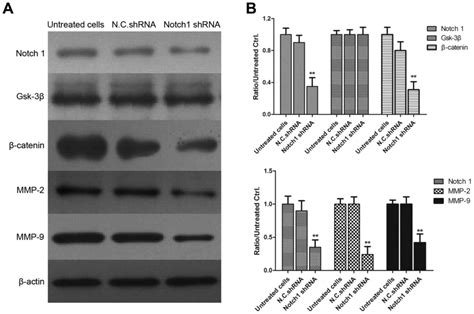 Interference Of Notch 1 Inhibits The Proliferation And Invasion Of