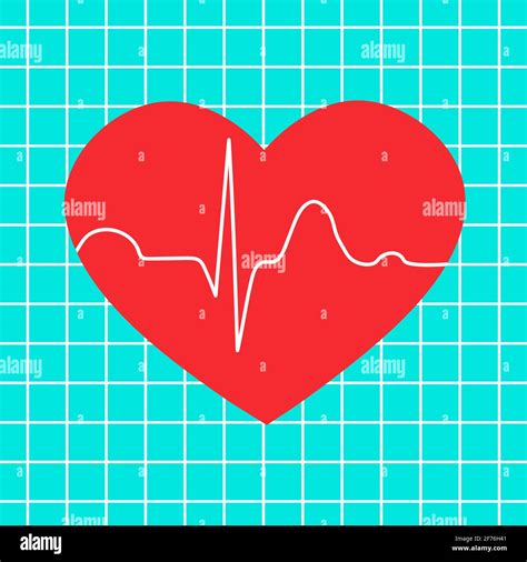 Ecg In Myocardial Infarction Banque D Images Vectorielles Alamy