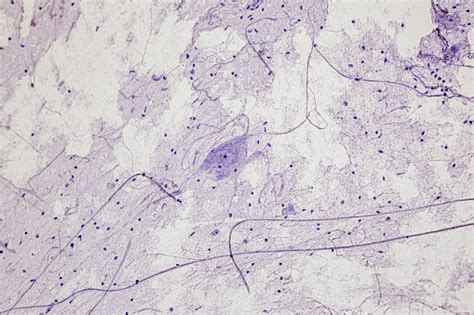 Motor Neuron Spinal Cord Nerve Fibres And Nerve Cells Under The ...