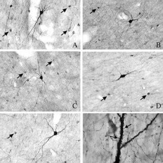 Photomicrographs Of Different Cytological Types Of Nadph D Type I