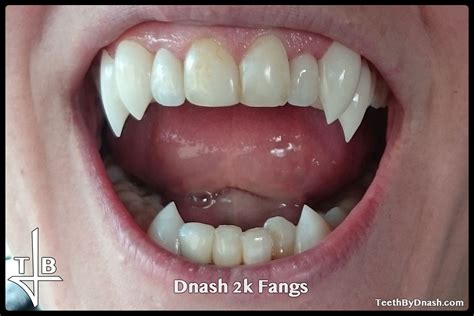 Dnash Teeth By Dnash