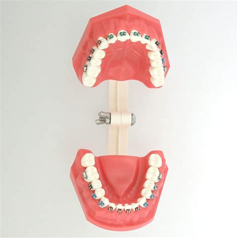 Snapklik Dentalmall Typodonts Orthodontics Demonstration Model