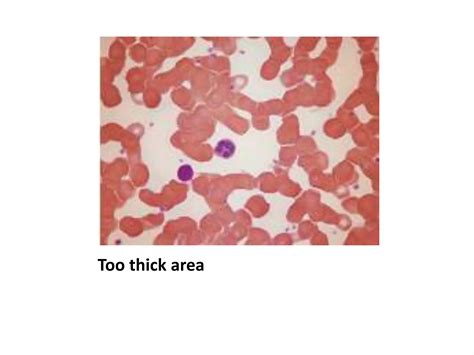 Peripheral Blood Smear Examination Ppt