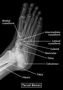 Tarsal Bones – Definition, Anatomy, Location, & Functions