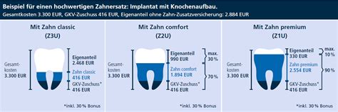 Private Zahn Zusatzversicherung Der R V Zahnzusatz