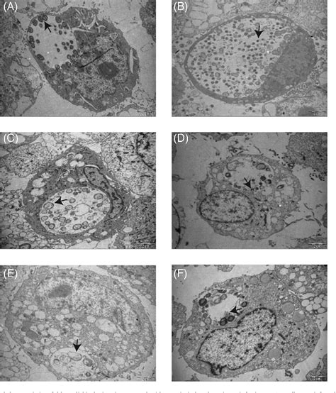 Figure 2 From An In Vitro Model Of Azithromycin Induced Persistent