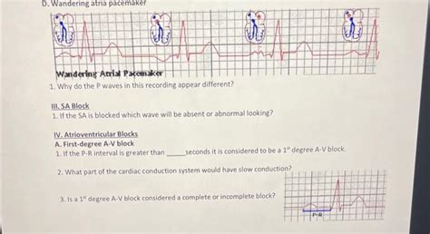 Solved 1. Why do the P waves in this recoraing appear | Chegg.com