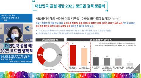 “골밀도 검사 주기 50대부터 4년마다 한 번씩 돼야”