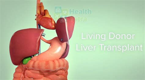 Live Donor Liver Transplant In India Updated 2024