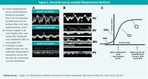 Bedside Echo Cardio Grafie In De Acute Setting Tijdschrift Voor