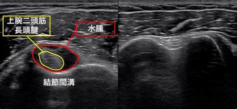 超音波検査 上田整形外科内科