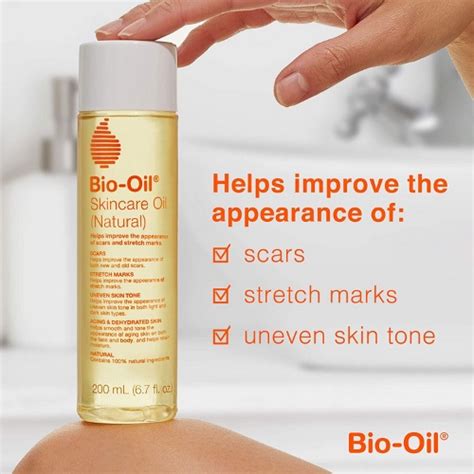 🔥local Seller🔥bio Oil Skincare Oil 200ml For Scar Stretch Marks Uneven Skin Tone Bio Oil