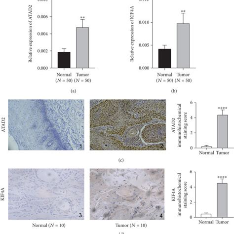 Atad And Kif A Are Highly Expressed In Escc A Atad In Normal