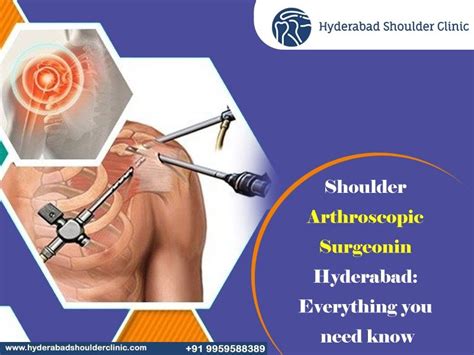 Shoulder Arthroscopic Surgeon In Hyderabad Everything You Need Know