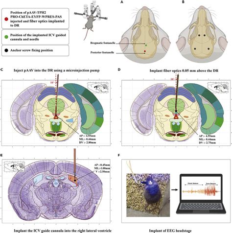 The Implantation Of Optical Fiber In DR And ICV Guide Cannula A The