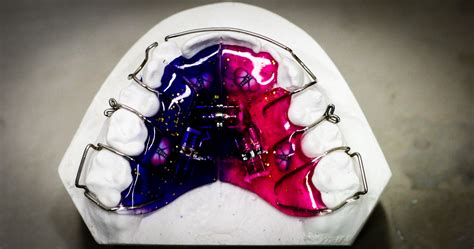 Laboratorium Ortodontyczne – Aparaty ruchome, szyny, ortodoncja.