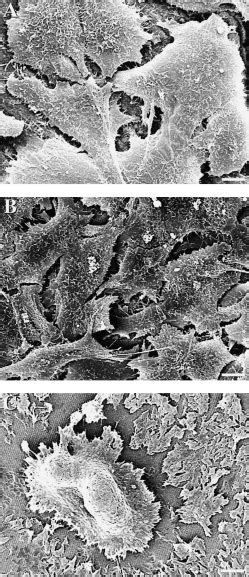 Scanning Electron Micrographs Of Cultured Mg63 Cells On The Dentin Download Scientific Diagram