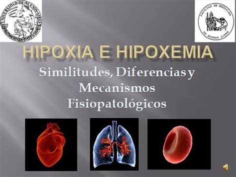 Diferencia Entre Hipoxia E Hipoxemia Encuentra La Diferencia