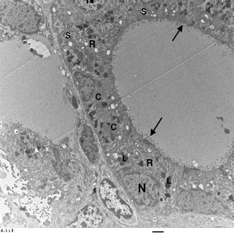 An Electron Micrograph Of Ultrathin Section Of Thyroid Gland Of A